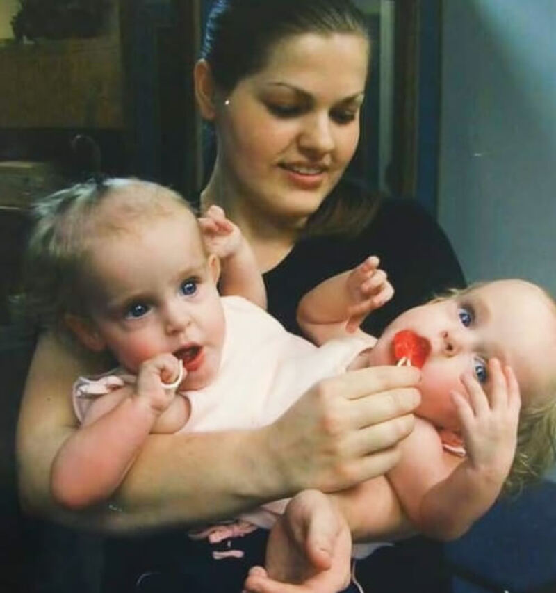 Attached at the Abdomen, Twins Kendra and Maliyah Were Born in 2002